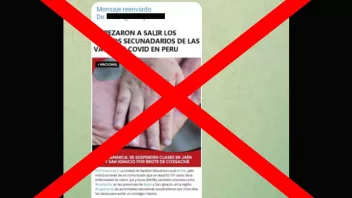 En redes sociales circula un mensaje que asegura que uno de los efectos secundarios de las vacunas contra la covid-19 son las erupciones cutáneas. 